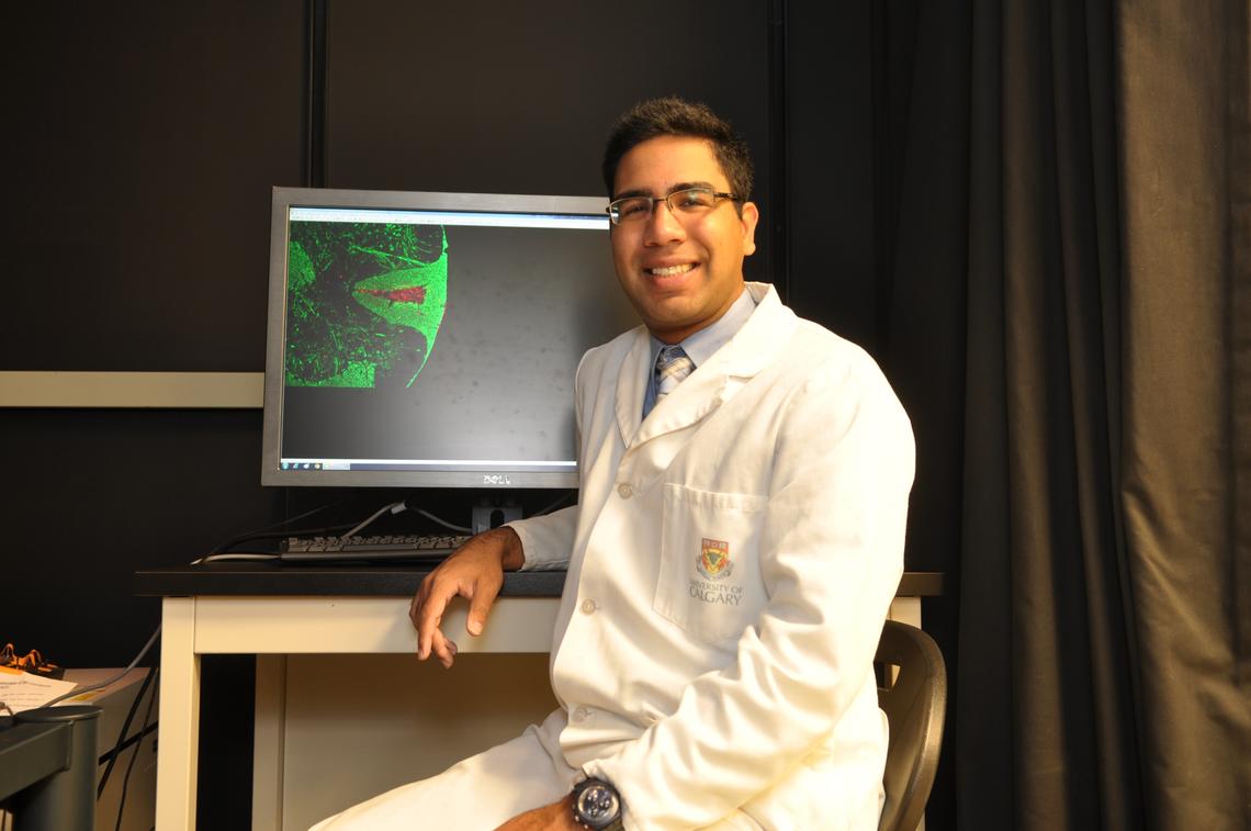 Vanier scholar Khalil Rawji is researching compounds which could be used to repair nerve damage in patients with MS.